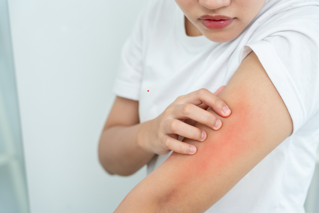 Close up of a woman scratching a dry itchy red skin rash on her arm caused by hard water irritation and chlorine exposure during a shower