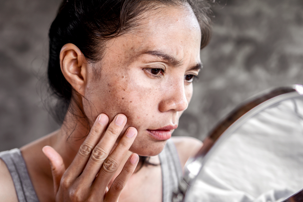 A woman looking closely in a mirror at skin acne breakouts and blemishes caused by washing her face with harsh chlorinated hard water